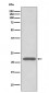 Anti-Peroxiredoxin 2 Rabbit Monoclonal Antibody